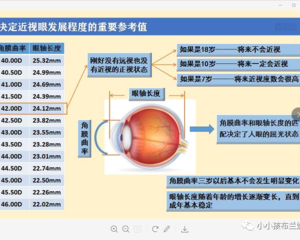 关于近视——一件